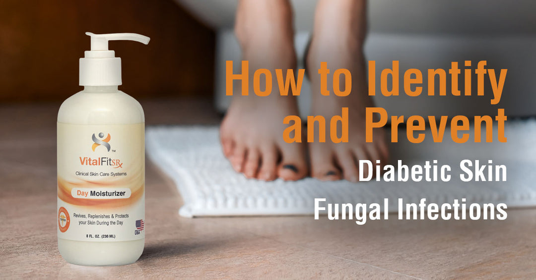 How to Identify and Prevent Diabetic Skin Fungal Infections