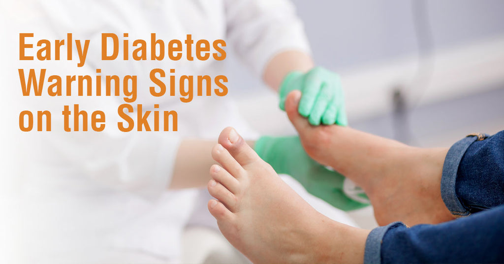 Early Diabetes Warning Signs on the Skin