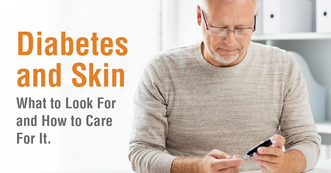 Diabetes and Skin -  What to Look For and How to Care For It.